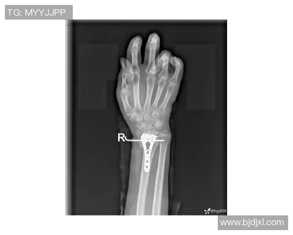 伤病公告：Sayaplayer因手腕伤势缺席2025春季赛_2480